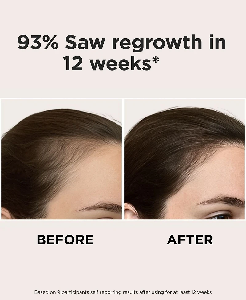 Solaris Laboratories Ny Intensive Led Red Light Therapy Headband