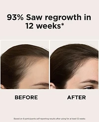 Solaris Laboratories Ny Intensive Led Red Light Therapy Headband