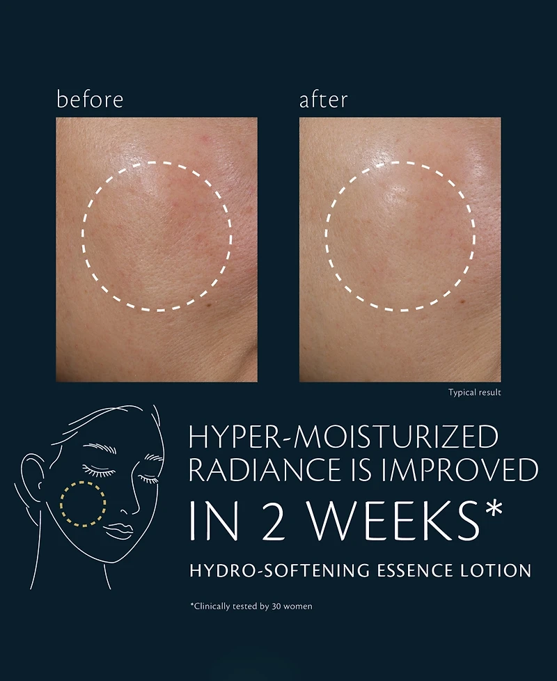 Cle de Peau Beaute Hydro-Softening Essence Lotion, 2.5 oz.