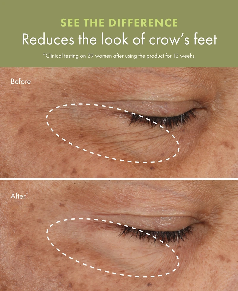 Origins Plantscription Wrinkle Correction Eye Cream with Encapsulated Retinol