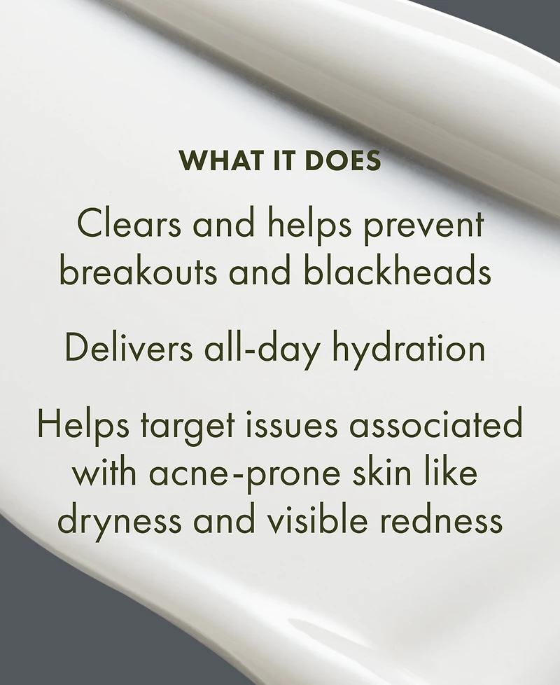 Origins Clear Improvement Acne Clearing Hydrating Lotion, 1.7 oz.