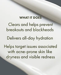 Origins Clear Improvement Acne Clearing Hydrating Lotion, 1.7 oz.