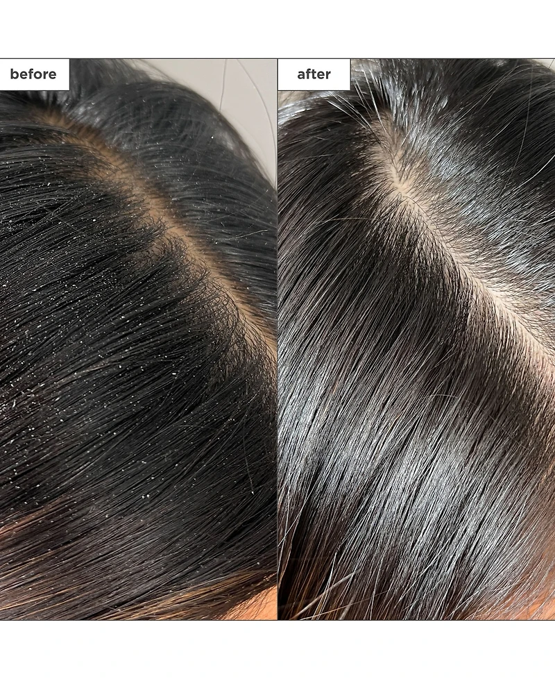 Briogeo Scalp Revival Charcoal + Tea Tree Buildup Detox Spray, 4 oz.