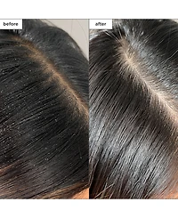 Briogeo Scalp Revival Charcoal + Tea Tree Buildup Detox Spray, 4 oz.