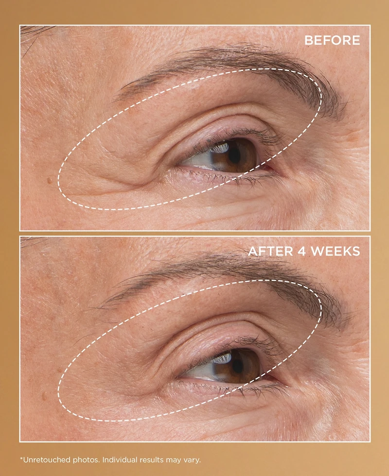 Perricone Md Neuropeptide Eyelid Lift Serum, 0.5 oz.