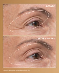 Perricone Md Neuropeptide Eyelid Lift Serum, 0.5 oz.