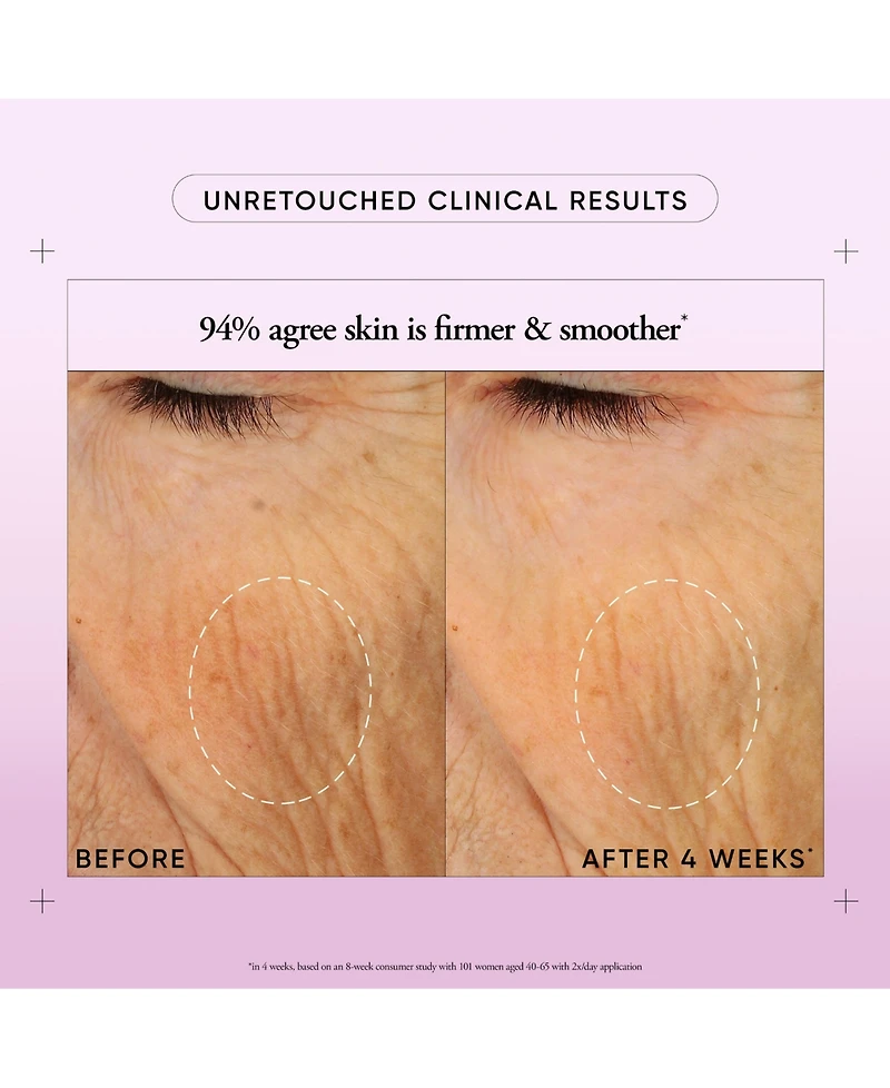 philosophy Ultimate Miracle Worker Nourish & Rejuvenate Face & Neck Cream