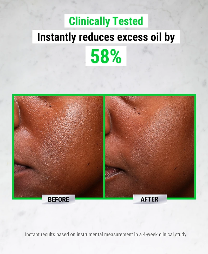 Kiehl's Since 1851 Ultra Pure High-Potency 5.0% Niacinamide Serum, 1 oz.