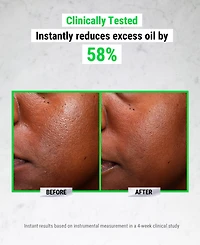 Kiehl's Since 1851 Ultra Pure High-Potency 5.0% Niacinamide Serum, 1 oz.