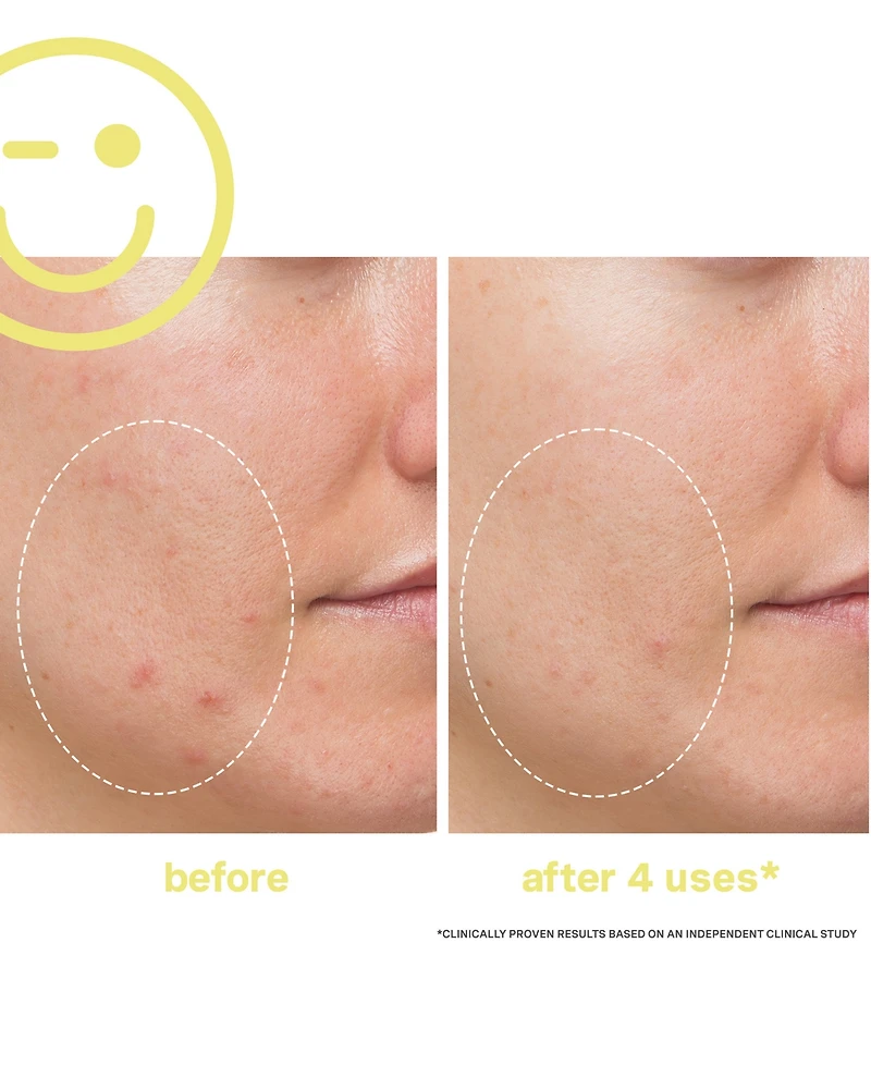 Kate Somerville Mega-c 30% Vitamin C Brightening Facial, 2 oz.