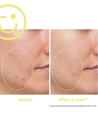 Kate Somerville Mega-c 30% Vitamin C Brightening Facial, 2 oz.