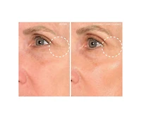 SiO Beauty Super EyeLift (4-Pk.)