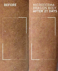 dr. brandt Microdermabrasion Body Polishing Exfoliator