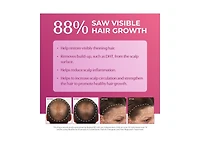 BosleyMD Womens Hair Re-growth Treatment 2% Minoxidil Dropper