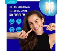 MySmile Prefilled Teeth Whitening Trays Kit, 12% Hydrogen Peroxide, Non-Liquid Gel Technology Tooth Whitening Trays, Whiten Teeth Faster, 7X Whitening