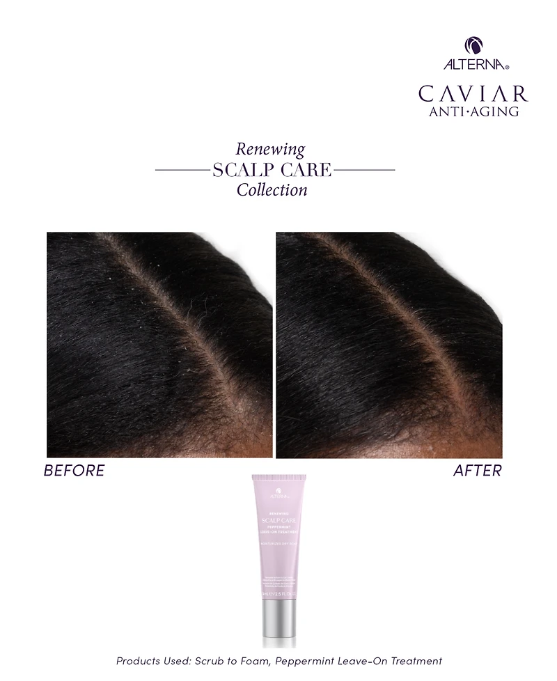 Alterna Renewing Scalp Care Peppermint Leave-On Treatment, 2.5 oz.