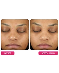 BeautyStat Universal Triple Action Daily Peel Pads, 10-Pk.