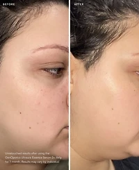Sk-ii GenOptics Ultraura Essence Serum, 1.6 oz.