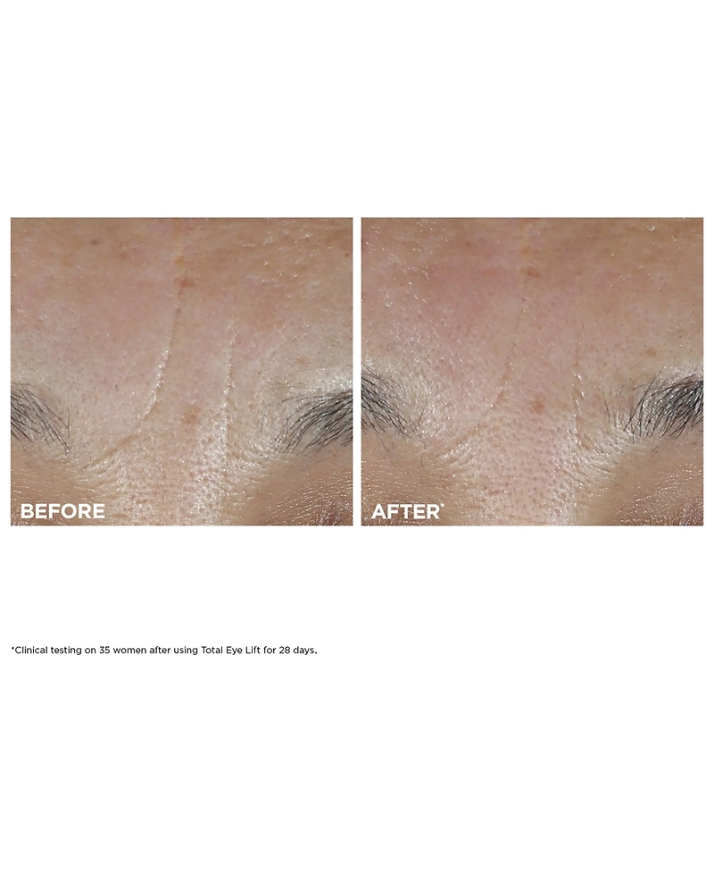 Clarins 3-Pc. Total Eye Lift Set