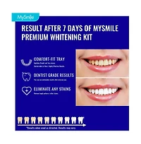 MySmile Prefilled Teeth Whitening Trays Kit, 12% Hydrogen Peroxide, Non-Liquid Gel Technology Tooth Whitening Trays, Whiten Teeth Faster, 7X Whitening