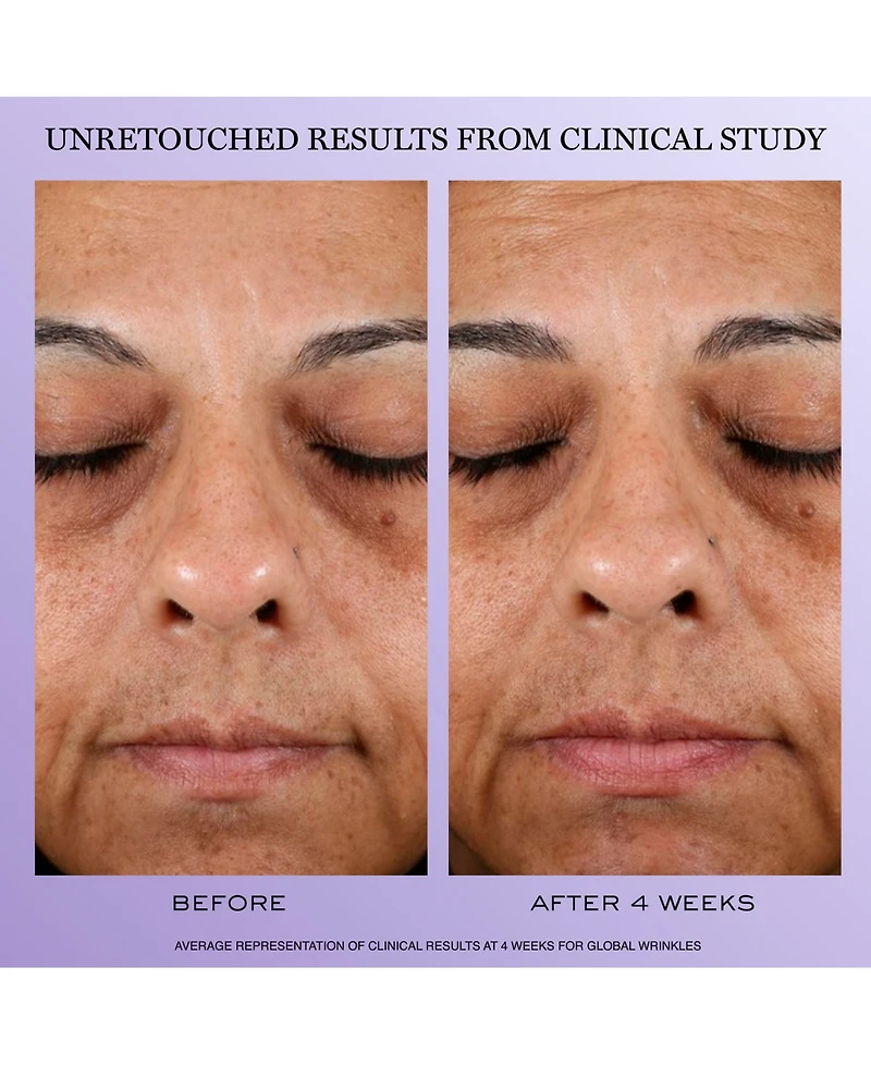 Lancome 4-Pc. Renergie Starter Kit Set