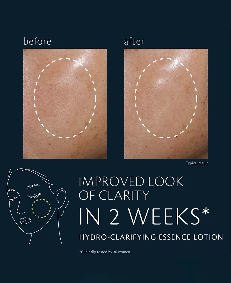 Cle de Peau Beaute Hydro-Clarifying Essence Lotion, 2.5 oz.