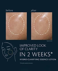 Cle de Peau Beaute Hydro-Clarifying Essence Lotion, 2.5 oz.