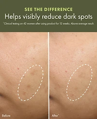 Origins Dr. Andrew Weil for Origins Mega-Mushroom Relief & Resilience Soothing Treatment Lotion, 6.7 oz.