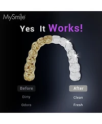 MySmile MS202B Cordless Ultrasonic Retainer and Jewelry Cleaning Pod for Home 48kHz with Digital Timer