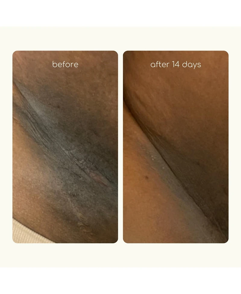 Forgotten Skincare The Original Underarm Brightening Deodorant Cream