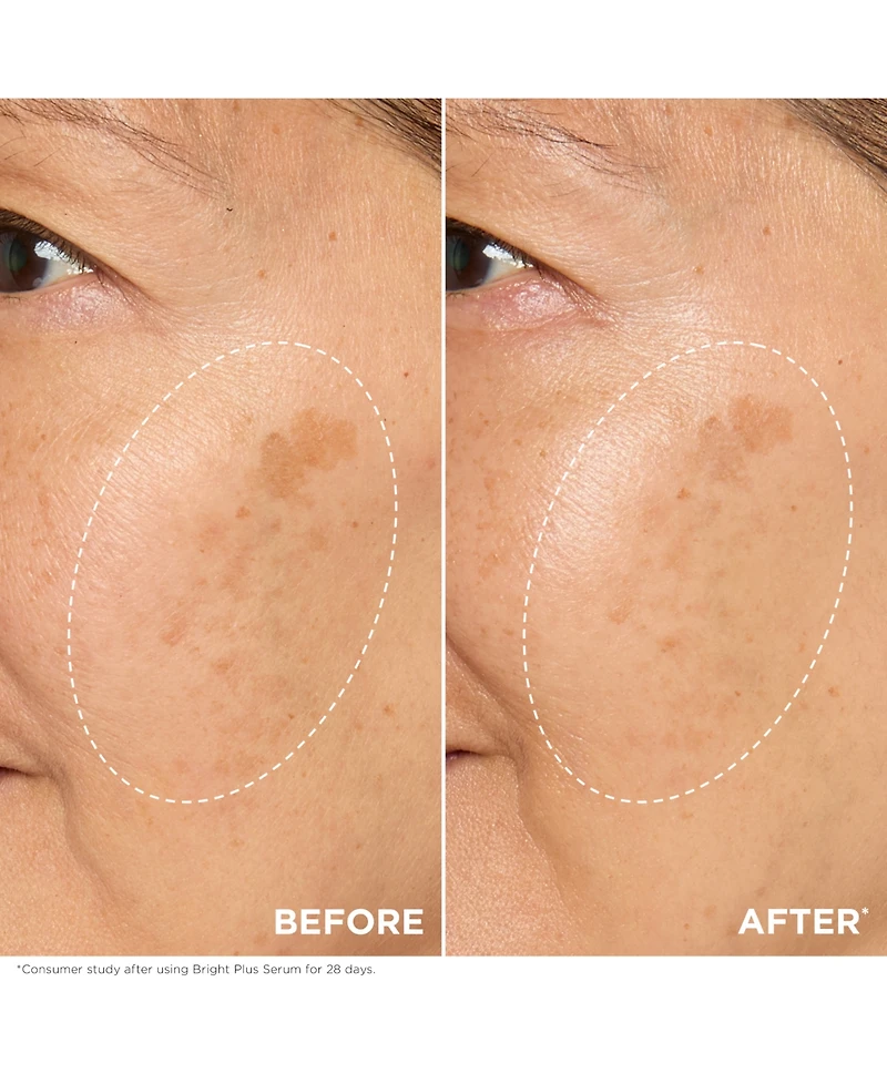 Bright Plus Brightening Vitamin C & Niacinamide Dark Spot Serum, 1 oz.