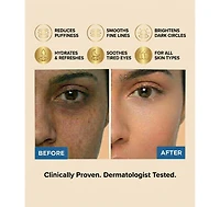 Lovery Vitamin C and Vitamin E Brightening Under Eye Masks - Korean Skincare Hydrating Eye Pad Set - 5 Pairs
