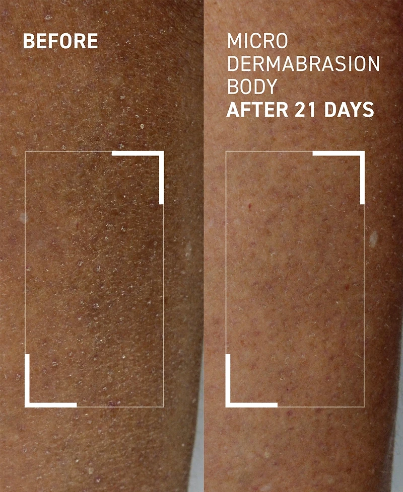 dr. brandt Microdermabrasion Body Polishing Exfoliator