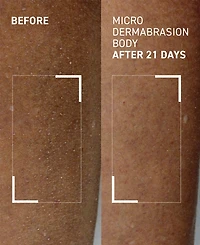 dr. brandt Microdermabrasion Body Polishing Exfoliator