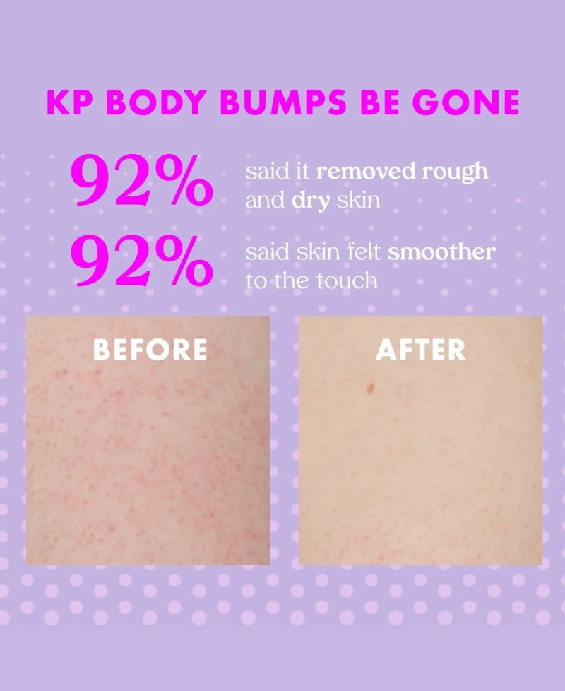 Kopari Beauty Kp Body Bumps Be Gone