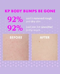 Kopari Beauty Kp Body Bumps Be Gone