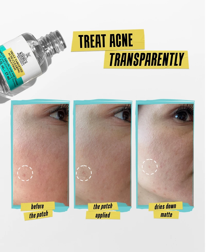 Kiehl's Since 1851 Truly Targeted Acne-Clearing Solution