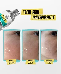 Kiehl's Since 1851 Truly Targeted Acne-Clearing Solution