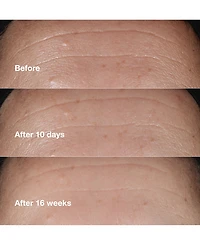 Clinique Smart Clinical Repair Wrinkle Correcting Serum