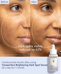Caudalie Vinoperfect Brightening Dark Spot Serum, 1 oz.