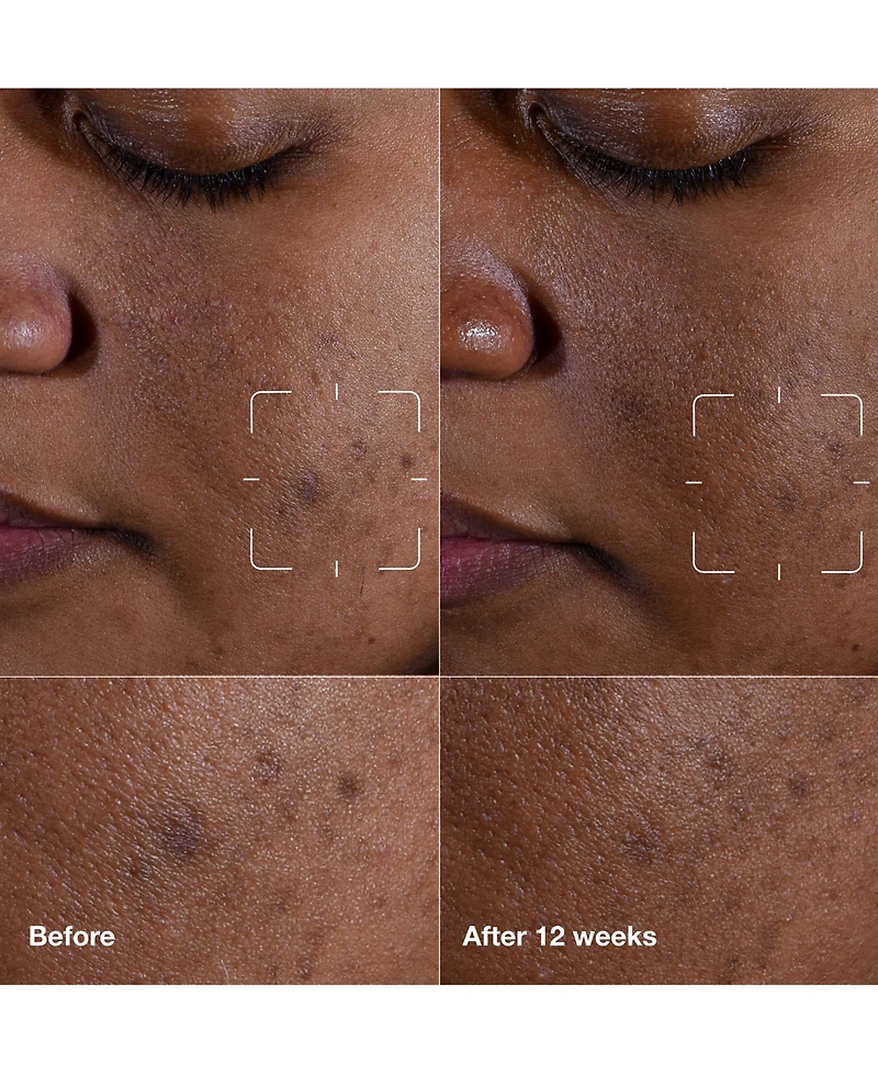 Clinique Even Better Clinical Dark Spot Clearing Serum with Vitamin C