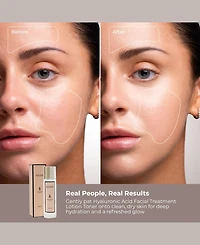 Vivienne Hu Facial Treatment Lotion Toner, 5.3 oz.