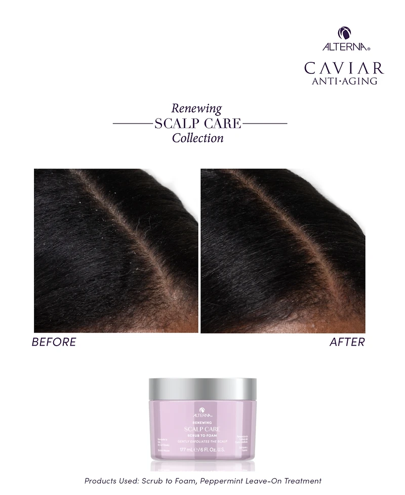 Alterna Renewing Scalp Care Scrub To Foam, 6 oz.