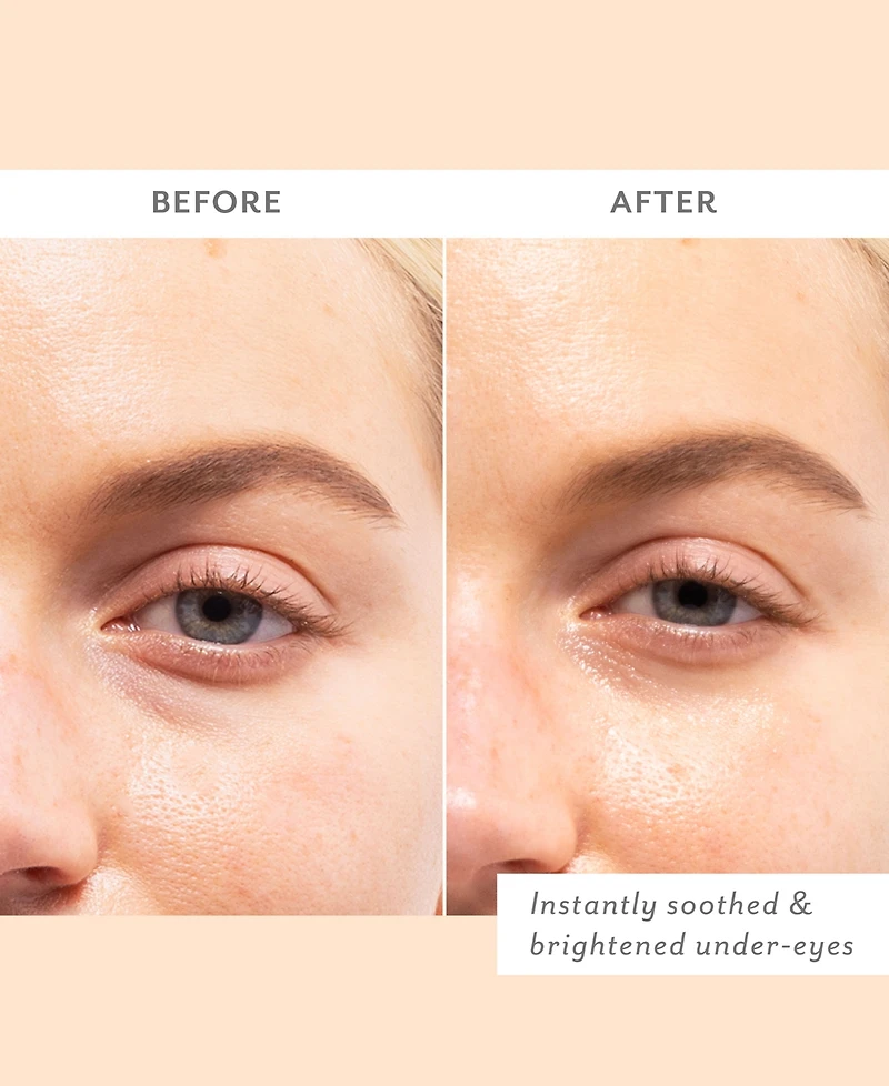 Patchology Skin Remedy Soothing Eye Gels, 5-Pk.