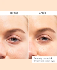 Patchology Skin Remedy Soothing Eye Gels, 5-Pk.