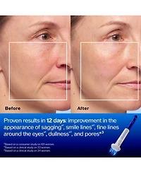 Shiseido Bio-Performance Micro-Click Concentrate
