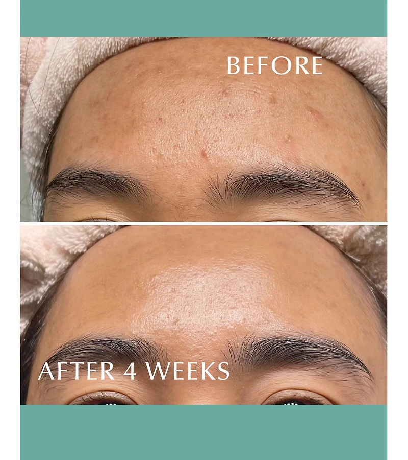 Albion Skin Conditioner Essential N