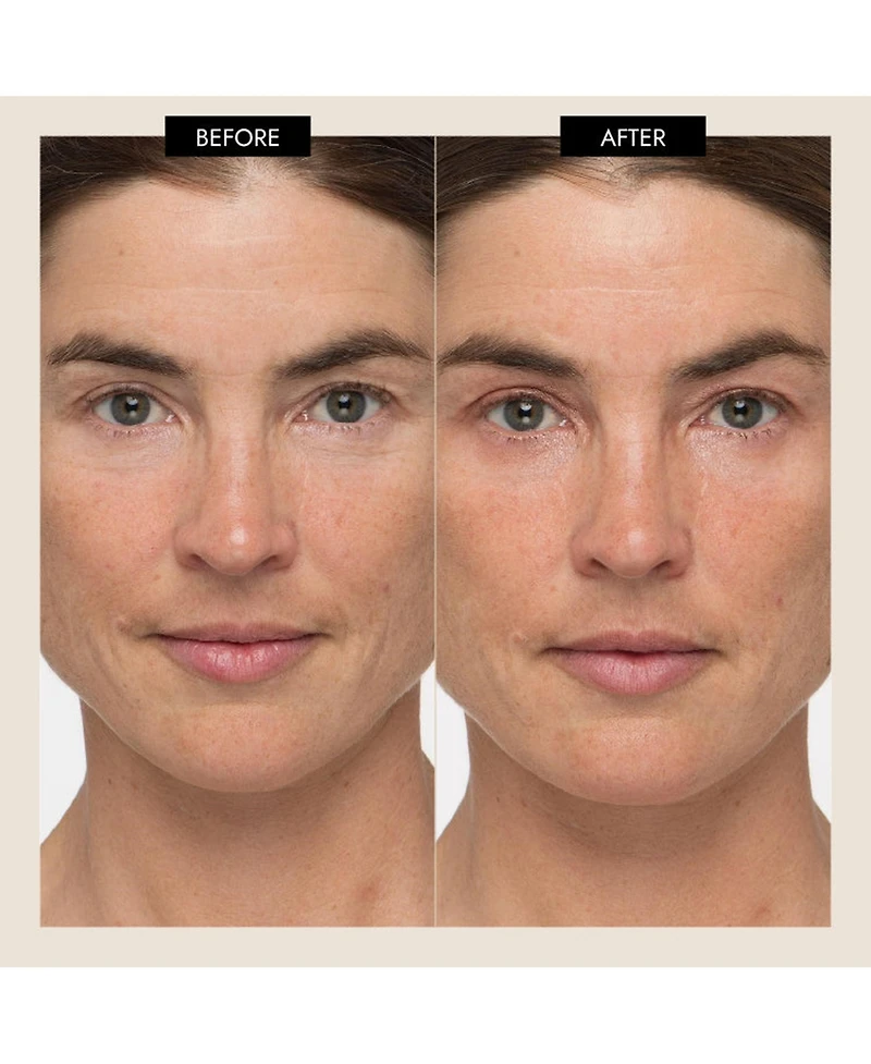 7E Wellness MyoLift TriWave Microcurrent Facial Device