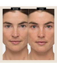 7E Wellness MyoLift TriWave Microcurrent Facial Device