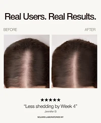 Solaris Laboratories Ny Red Led Light therapy Hair Growth Cap